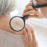 Skin Cancer Awareness Starts With You