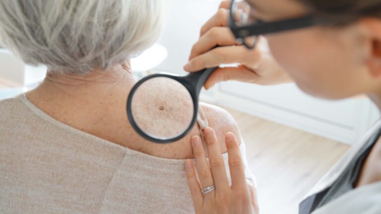 Skin Cancer Awareness Starts With You