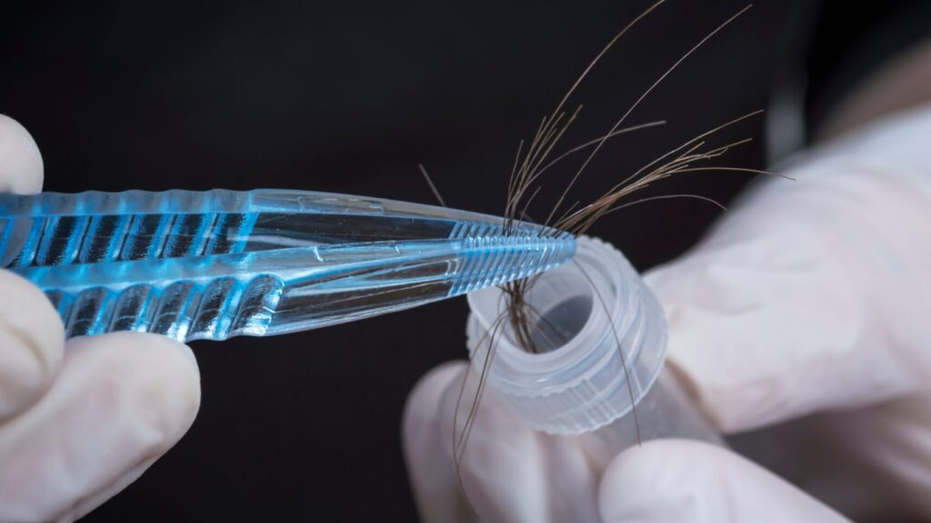 What Your Blood Work Can’t Tell You: The Simple Hair Test That Reveals What’s Really Going On Inside Your Body