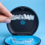 Invisalign Basics: What to Know Before You Begin