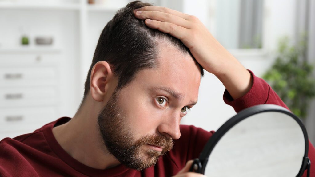 A New Approach to Hair Restoration: No Needles, No Downtime