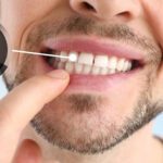 Why Dental Implants Fail — and How We Can Prevent It