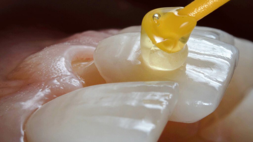 State of the Art of Dentistry?
