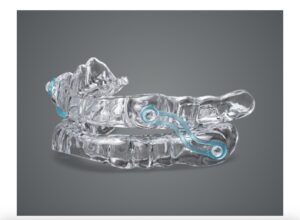 Silent Nite® sleep apnea mouth guard