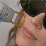 Selfcare on the Go: Introducing the “Lunchtime” Laser Facial