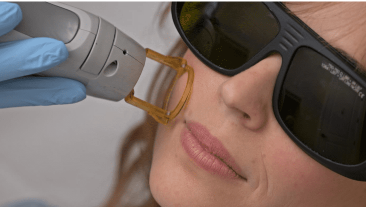 Selfcare on the Go: Introducing the “Lunchtime” Laser Facial