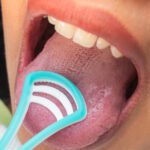 Why Tongue Scraping Matters More Than You Think