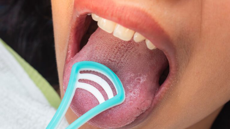 Why Tongue Scraping Matters More Than You Think