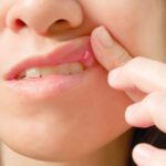 Evaluating Lumps and Bumps in the Mouth