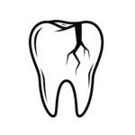 Cracked Teeth: What Clarkston Residents Should Know to Protect Their Smiles