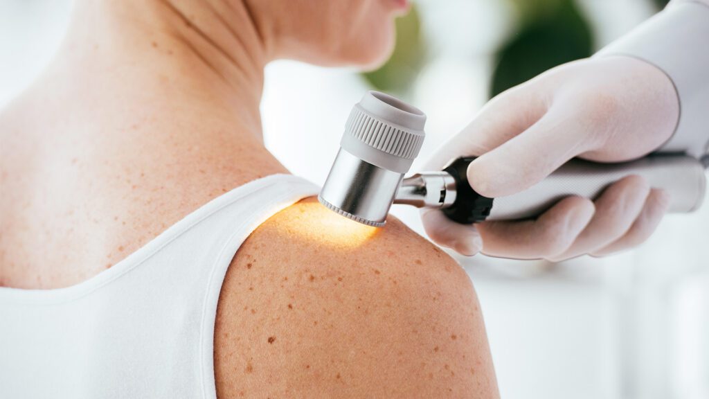 Why Would I Pay a Membership Fee to See a Dermatologist?