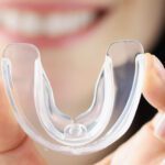 Protecting Young Smiles: Dental Injuries in Youth Sports