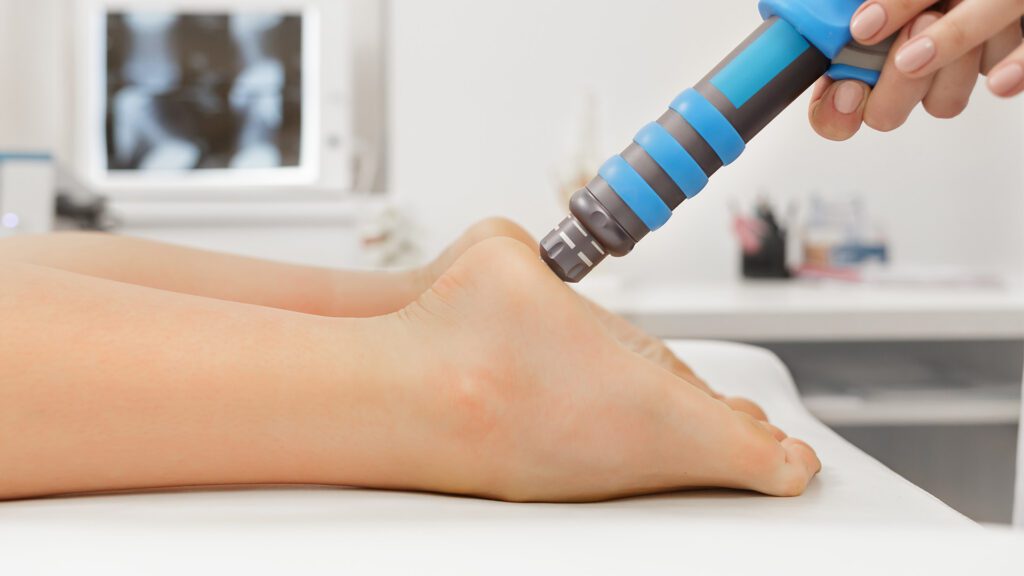 Shockwave Therapy: A Game-Changer in Sports Podiatry