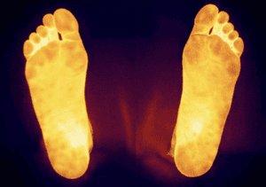 After neuropathy