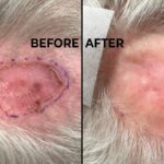 Beyond Melanoma: Modern, Non-Surgical Options for Common Skin Cancers