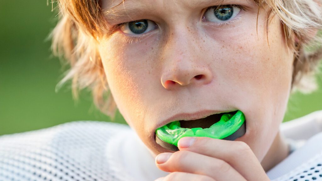 Why Mouthguards Matter in Kids