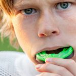 Why Mouthguards Matter in Kids