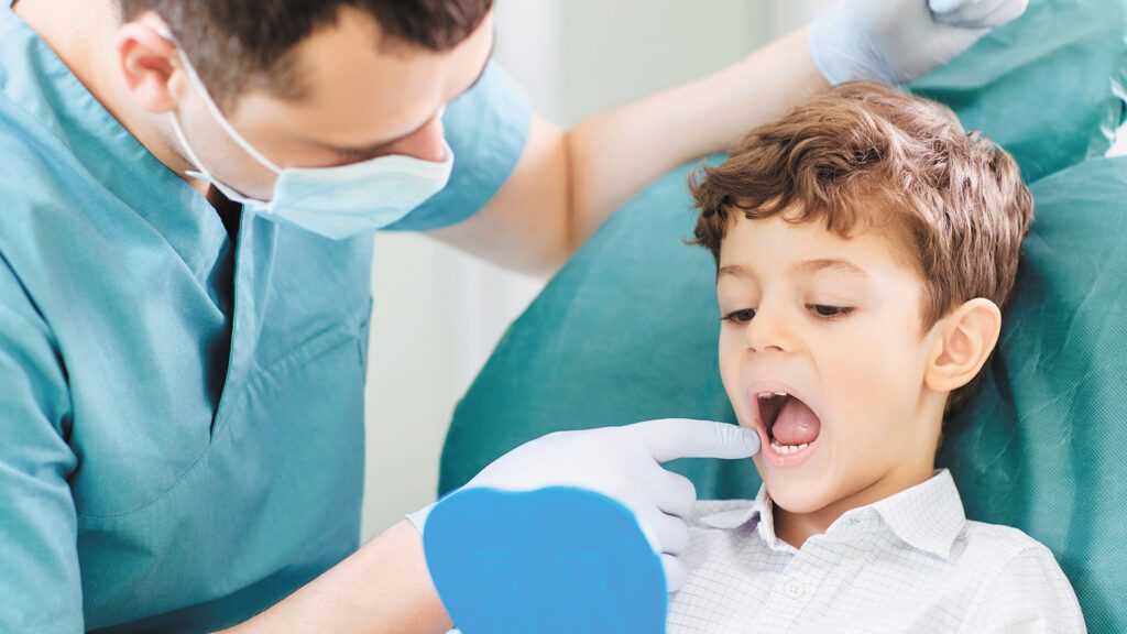 A Sealed Tooth is Better Than a Filled Tooth