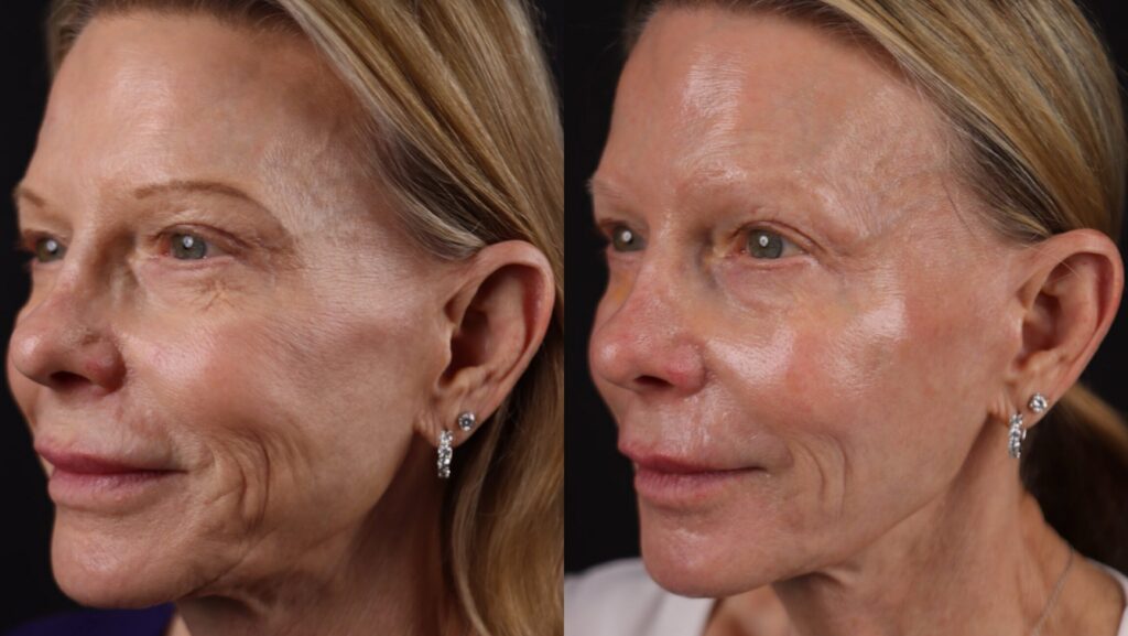 Dignity Medical Aesthetics & Wellness Delivers Impressive Non-Surgical Rejuvenation in El Dorado Hills