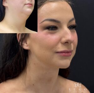 Jaw-Lugo-Plastic-Surgery.jpeg
