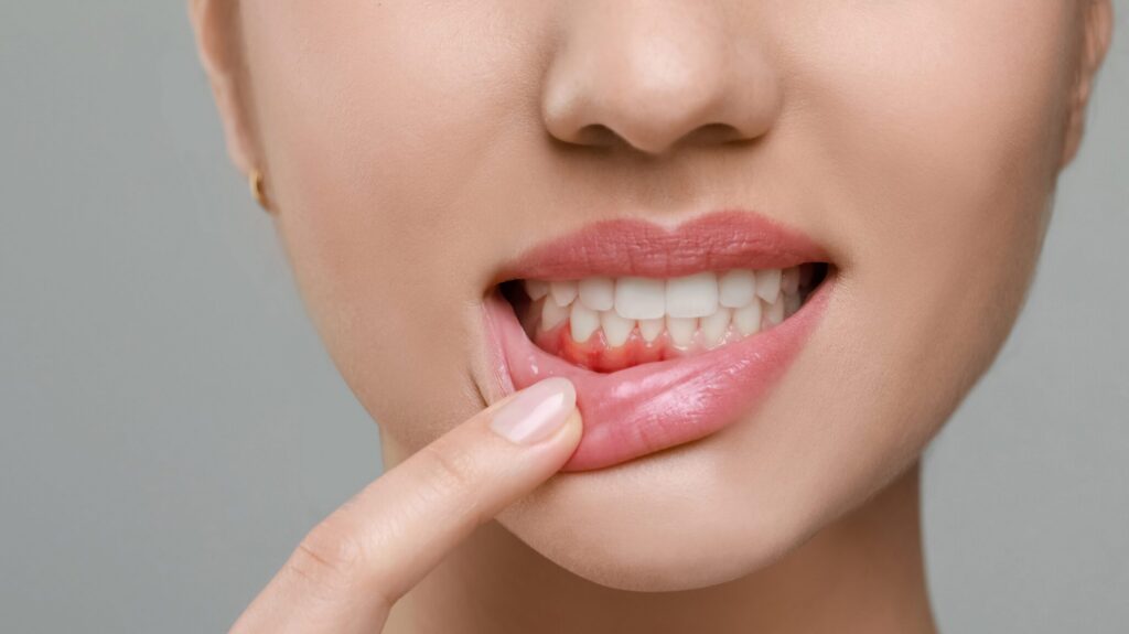Your Teeth Just Called…