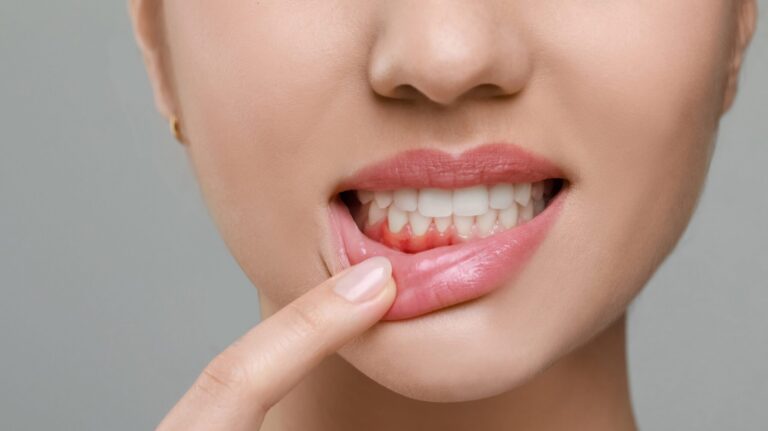 Your Teeth Just Called…