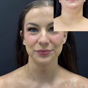 NeckLugo-Plastic-Surgery.jpeg