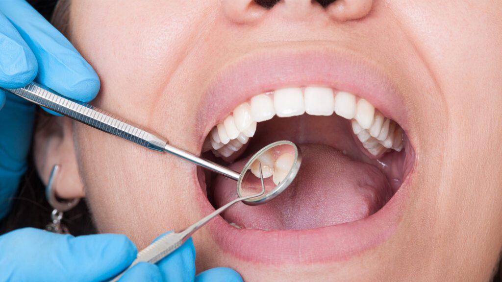Curodont: Treating Early Cavities Without the Drill