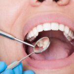 Curodont: Treating Early Cavities Without the Drill