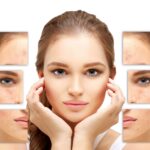 Clear Skin Starts with a Plan: Understanding Acne Treatments During National Acne Awareness Month
