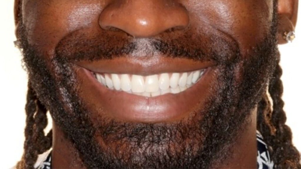 When Should You or Your Child See an Orthodontist?