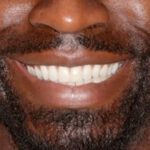When Should You or Your Child See an Orthodontist?