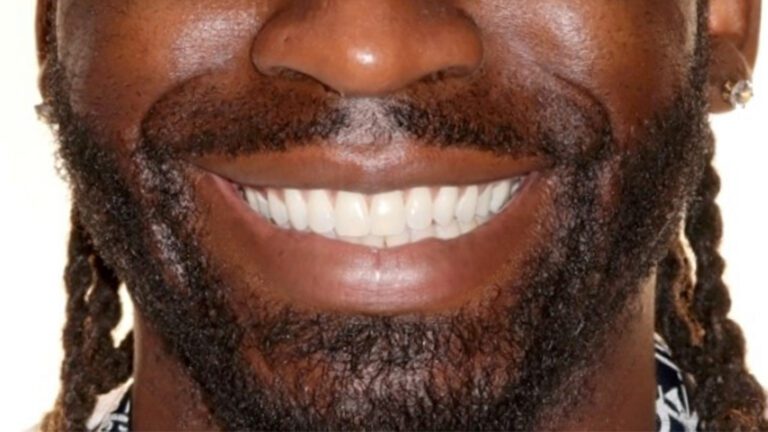 When Should You or Your Child See an Orthodontist?