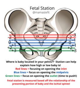 Uplift Diagram-Uplift Pelvic Health and Performance LLC