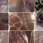 Why So Many People Come to Myofascial Release After Trying Everything Else: Understanding why the John F. Barnes Myofascial Release Approach® may be the missing piece