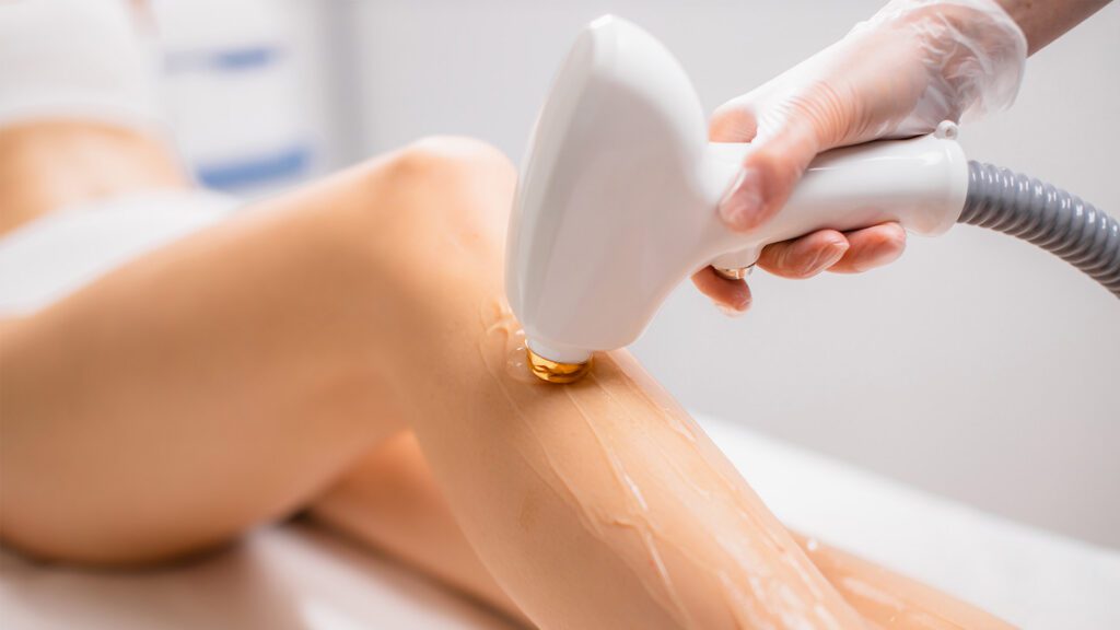 Discover the Future of Hair Removal With Triton Laser Technology at Luveva Spa