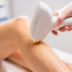 Discover the Future of Hair Removal With Triton Laser Technology at Luveva Spa