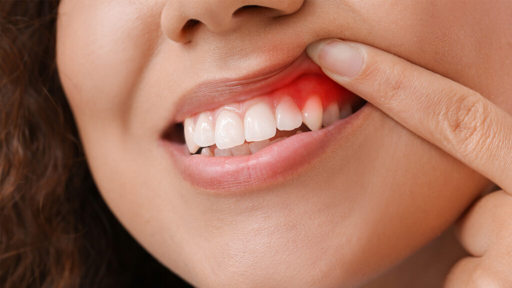 Healthier Dental Habits for a Healthier You!