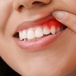 Healthier Dental Habits for a Healthier You!