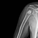 The Living Story of Bone: Beyond Calcium