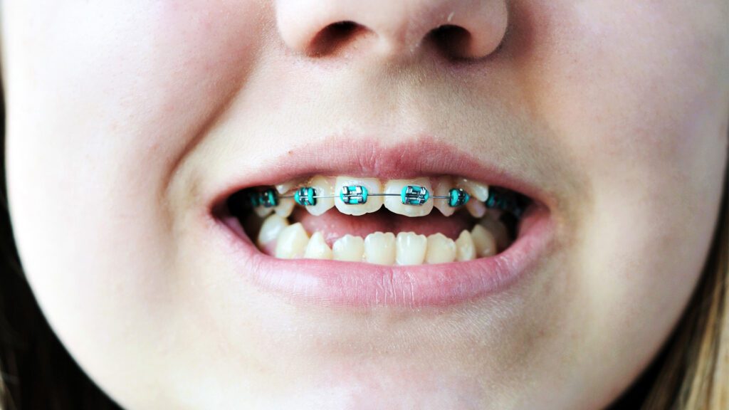 It Takes a Team: How Dental Specialists Help Your Child Smile