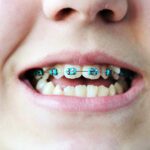 Trust Matters More Than Braces