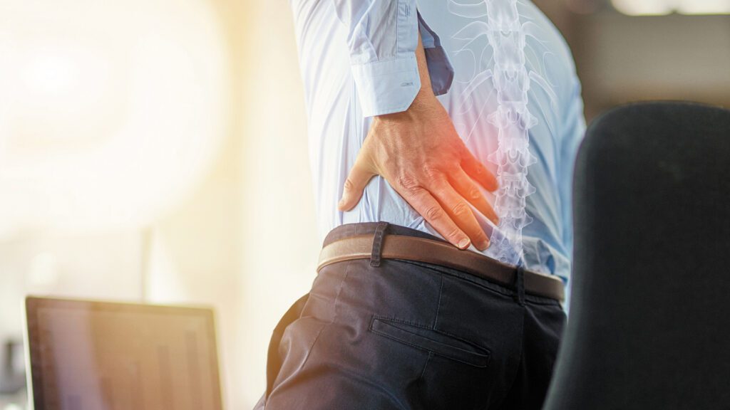 Episodic Back Pain