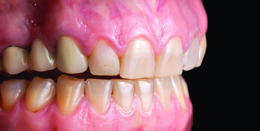 Wearing Blue Line Dental