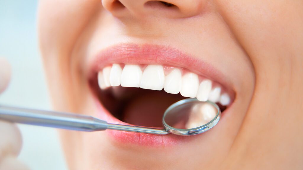 Cosmetic Dentistry That Looks Natural: Whitening, Veneers, and Smile Makeovers