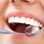 Cosmetic Dentistry That Looks Natural: Whitening, Veneers, and Smile Makeovers