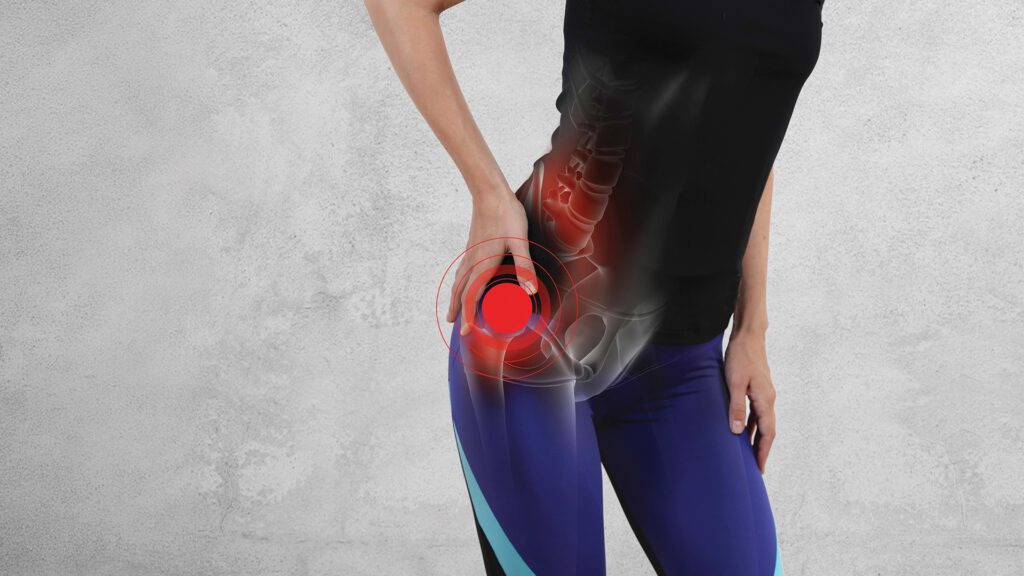 Hip Pain and Osteoarthritis: How Physical Therapy Can Help