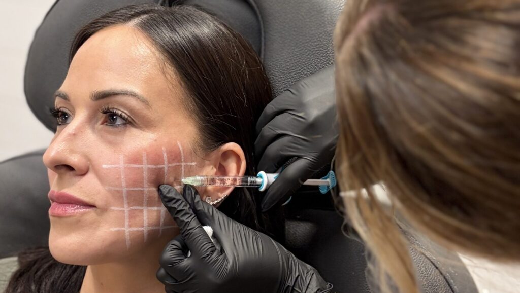 Celebrating 20 Years of Juvéderm at JEM Medspa