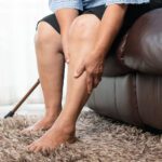 Is It the Heat … or Something More? Understanding Summer Leg Swelling