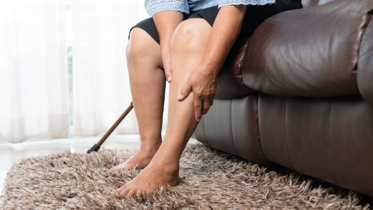 Is It the Heat … or Something More? Understanding Summer Leg Swelling